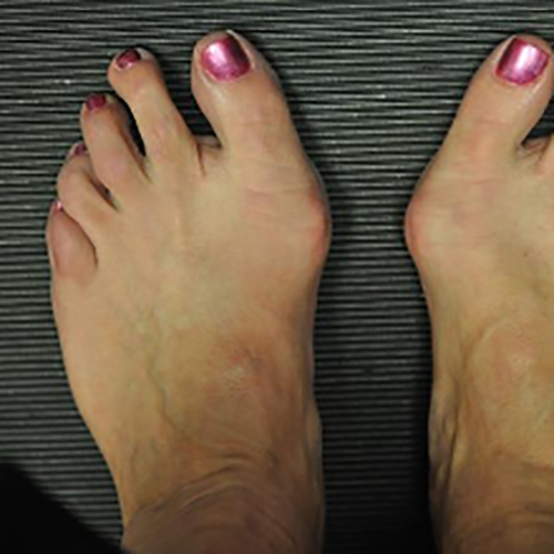 I migliori scarponi da trekking per borsiti